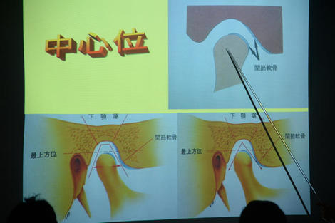 2016『顎関節症ライブ実習コース』〜その3〜