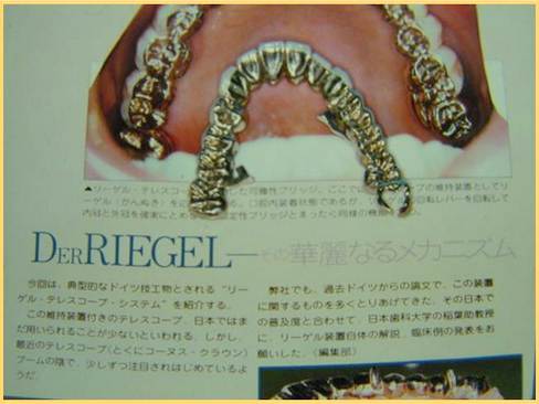 リーゲルテレスコープのご紹介〜歴史編〜