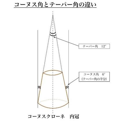 コーヌスクローネのご紹介〜コーヌス角とテーパーの違いについて〜